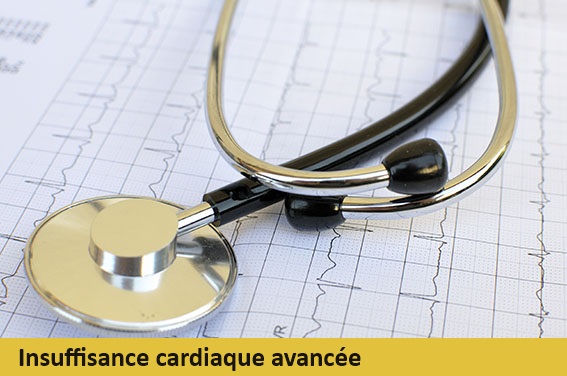 Prise en charge de l'insuffisance cardiaque3